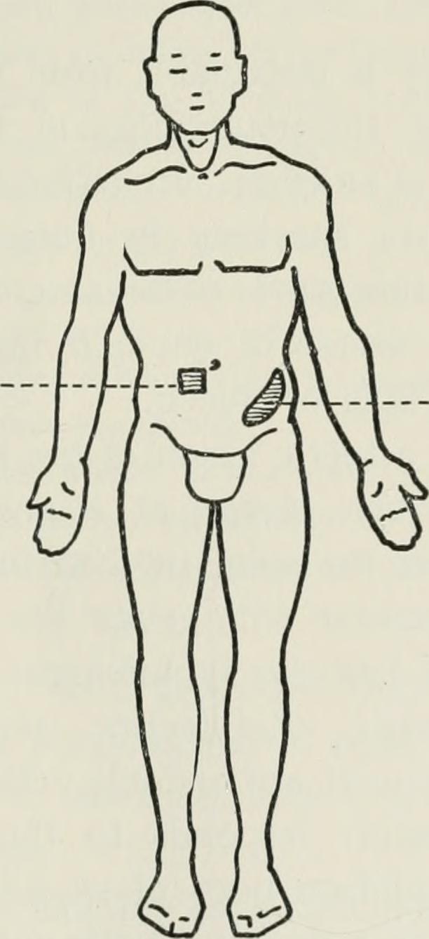 A printed line drawing of a standing male figure with a horizontal dashed reference line across the torso and small shaded markings indicating body areas.