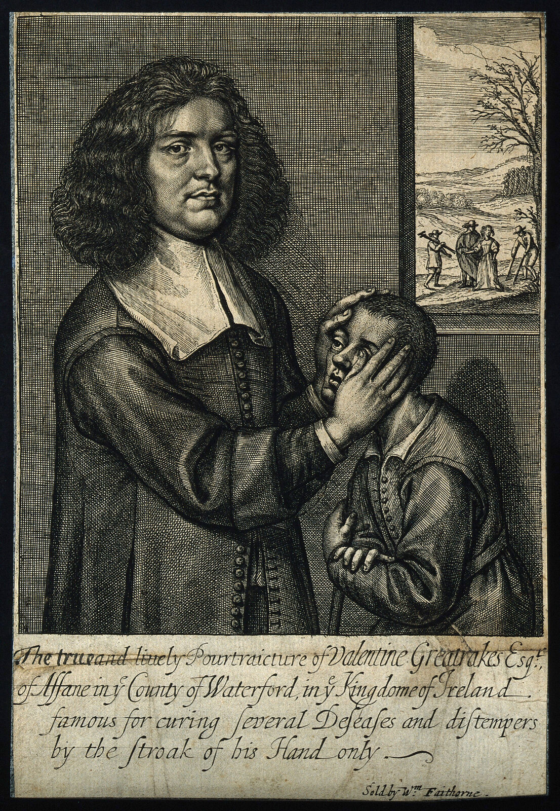 17th-century line engraving of Valentine Greatrakes, a long-haired man in a gown, laying his hand on the face and head of a seated boy, with a background vignette of figures including a man on crutches.