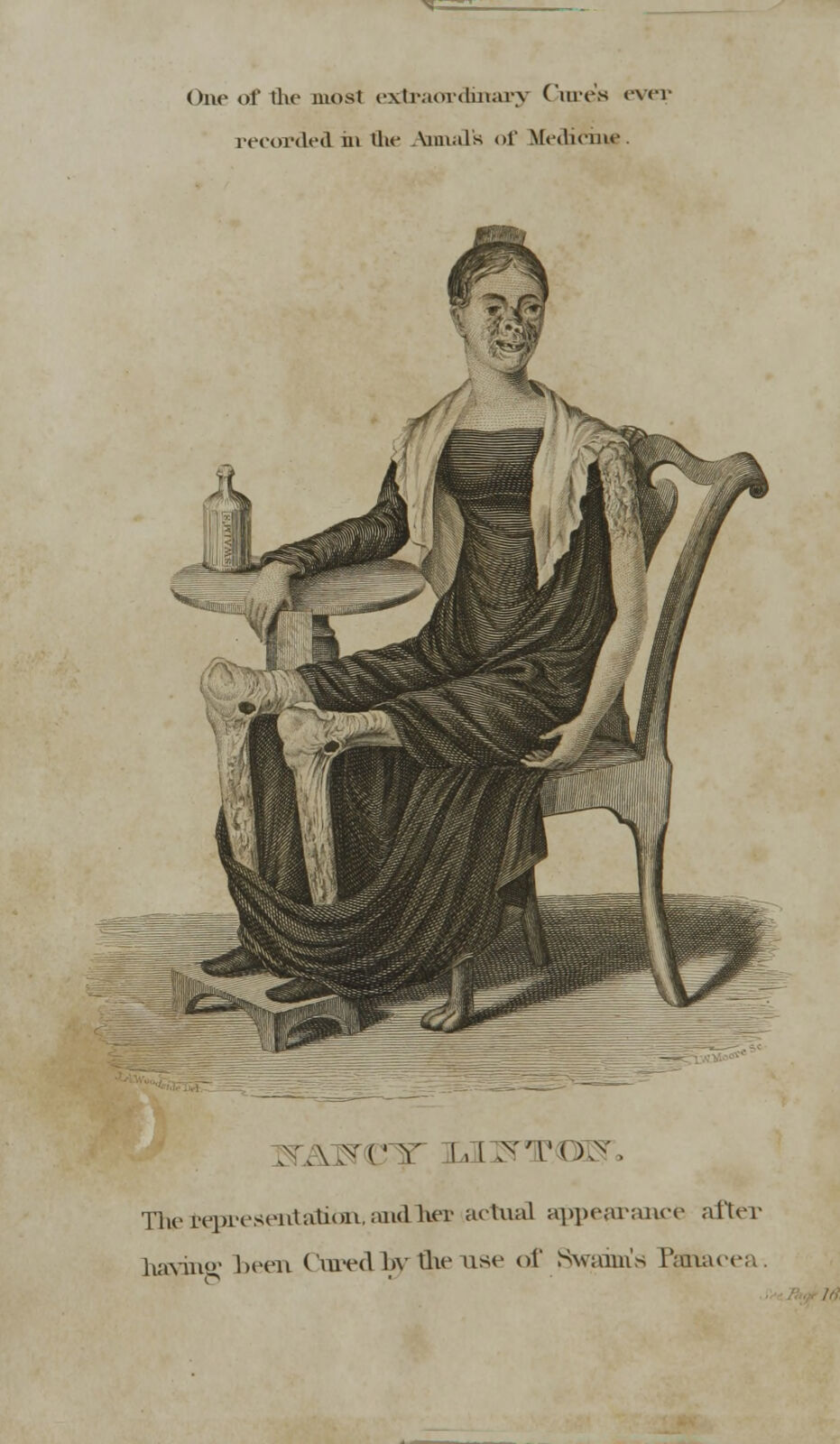 Engraved before-and-after testimonial illustration captioned Nancy Linton, showing a seated woman with a disfigured face and a leg drawn with the flesh wasted away to expose bone-like structure, beside a labelled bottle on a side table