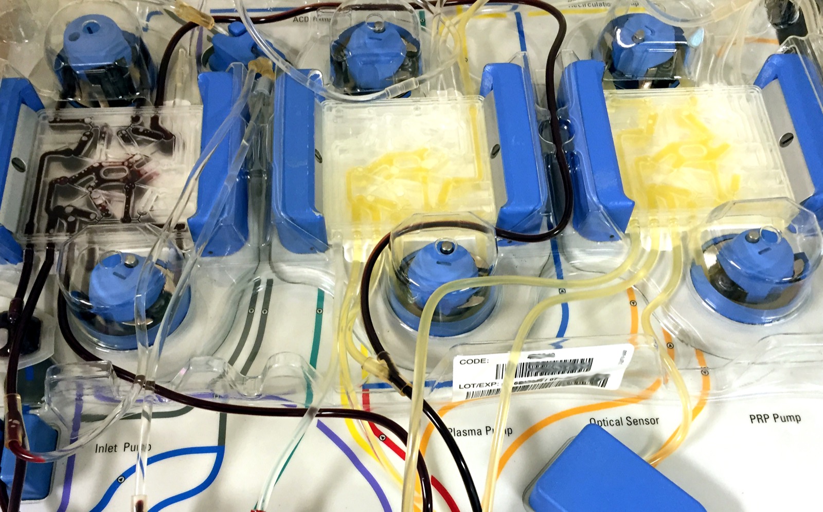 Close photograph of apheresis machine tubing, pumps, fluid channels, and labeled plasma and PRP pump areas.